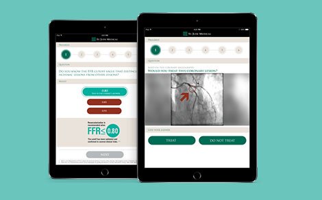 St. Jude Medical app is een succes op de EuroPCR beurs in Parijs